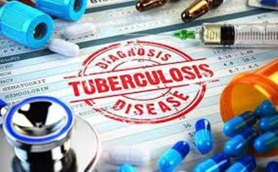 ଯକ୍ଷ୍ମା ରୋଗୀଙ୍କ ଚିକିତ୍ସା ସୁନିଶ୍ଚିତ କରିବାକୁ ସ୍ୱାସ୍ଥ୍ୟ ମନ୍ତ୍ରଣାଳୟ ପକ୍ଷରୁ ରାଜ୍ୟ/ କେନ୍ଦ୍ରଶାସିତ ଅଞ୍ଚଳଗୁଡିକୁ ପରାମର୍ଶ