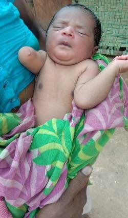 ଗୋଟିଏ ହାତ ନ ଥାଇ ନବଜାତ ସନ୍ତାନ ଧରା ପୃଷ୍ଠରେ