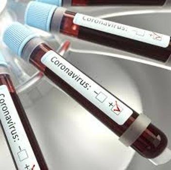 ବନ୍ତରେ ନୂଆ କରୋନା ପଜେଟିଭ୍ ଚିହ୍ନଟ