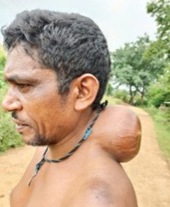 ଅର୍ଥ ସାଜୁଛି ବାଧକ : ମାଂସ ପିଣ୍ଡୁଳା ବୃଦ୍ଧି ପାଇବାରେ ଲାଗିଛି