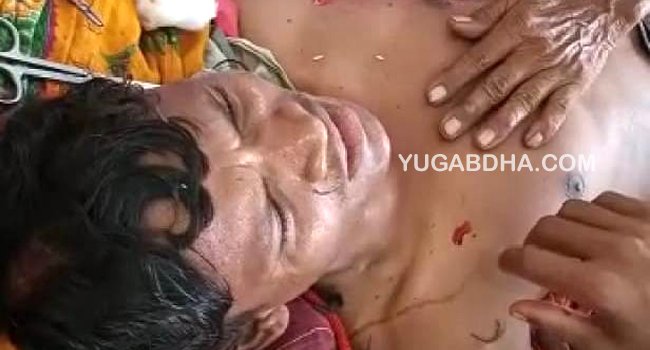 ଭାଲୁ ଆକ୍ରମଣ ରେ ଗାଈ ଚରାଳୀ ଗୁରୁତର