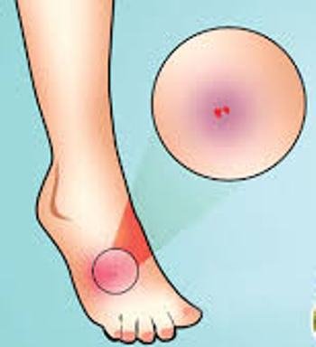 ସର୍ପାଘାତରେ ଶିଶୁପତ୍ରର ମୃତ୍ୟୁ