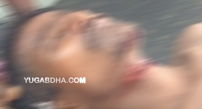 କ୍ଷତାକ୍ତ ଯୁବକଙ୍କୁ ଗଛ ଉପରୁ ଉଦ୍ଧାର