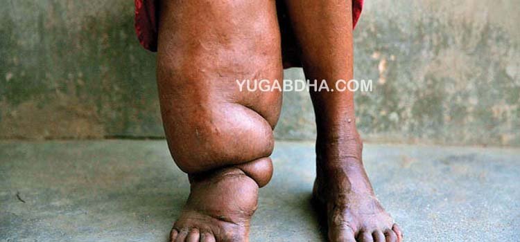 ଫାଇଲେରିଆ ରୋଗ ନିରାକରଣ ପାଇଁ ଜିଲା ସ୍ତରୀୟ ବୈଠକ