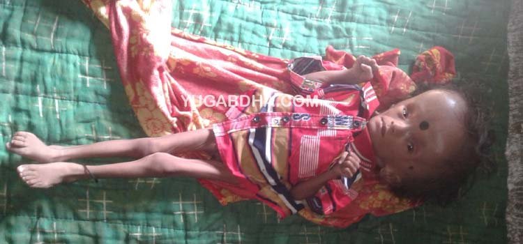 ଅସ୍ୱାଭାବିକ ଭାବେ ବଢ଼ୁଛି ଦେଢ଼ ବର୍ଷ ଶିଶୁର ମୁଣ୍ଡ, ଚିନ୍ତାରେ ପରିବାର
