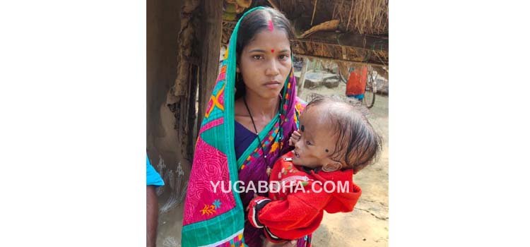 ବୃଦ୍ଧି ପାଉଛି ଶିଶୁର ମୁଣ୍ଡ, ଚିନ୍ତାରେ ପରିବାର