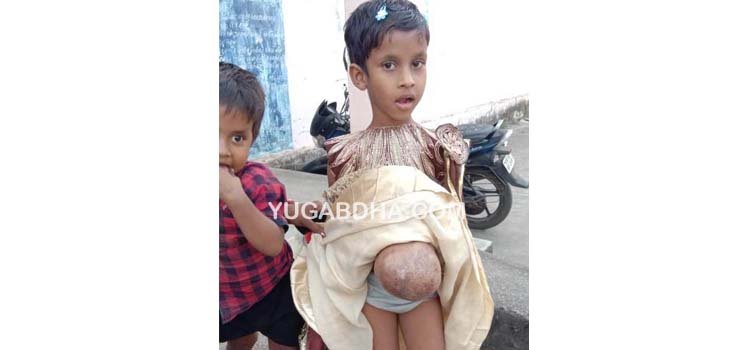 ପେଟରେ ମାଂସ ପିଣ୍ଡୁଳା ବଢୁଥିବା ମାମାଙ୍କ ଚିକିତ୍ସା ଦାବି, ଅତରିକ୍ତ ଜିଲ୍ଲାପାଳଙ୍କୁ ଭେଟିଲେ ଜୟ ଜଗନ୍ନାଥ ଗ୍ରୁପ୍