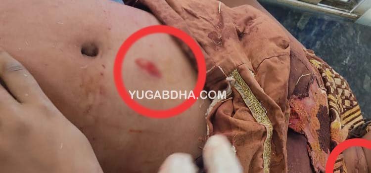 ସାମାନ୍ୟ ବଚସାରୁ ୧୧ବର୍ଷର ଝିଅକୁ ଛୁରା ମାଡ଼