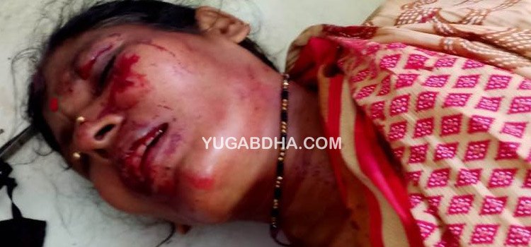 ସଡକ ଦୁର୍ଘଟଣାରେ ଦମ୍ପତ୍ତି ଆହାତ