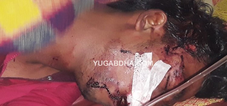 ଡ଼ିମିରିପଲି ଗ୍ରାମ ର ଛକ ଠାରେ ବାଇକ ଦୁର୍ଘଟଣାରେ 2 ଜଣ ଗୁରୁତର