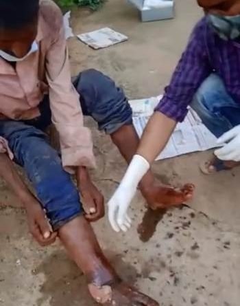 ଅଜଣା ବ୍ୟକ୍ତିଙ୍କ ପଚି ଯାଇଥିବା ଗୋଡ଼କୁ ପରିଷ୍କାର କଲେ ସାମାଜିକ କର୍ମୀ