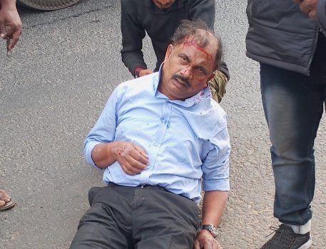 ପୃଥକ୍ ଦୁର୍ଘଟଣା ଘଟି ଦୁଇ ଆହତ