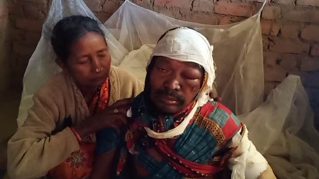 ନିଆଁରେ ପୋଡି ବୃଦ୍ଧ ଗୁରୁତର