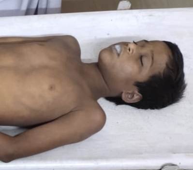 ବିବାଦ ଘେରରେ ବେଲଗୁଣ୍ଠା ସ୍ଵାସ୍ଥ୍ୟକେନ୍ଦ୍ର : ଚିକିତ୍ସା ଅବହେଳାରୁ ଚାରି ବର୍ଷର ଶିଶୁ ମୃତ୍ୟୁ ଅଭିଯୋଗ