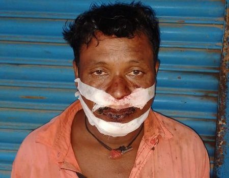 ପଥର ମାଡରେ ଜଣେ ଆହତ