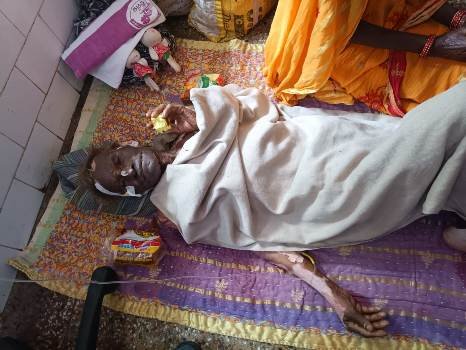 ଗ୍ୟାସ ଚୁଲାରୁ ପୋଡ଼ି ହୋଇ ବୃଦ୍ଧ ଗୁରୁତର
