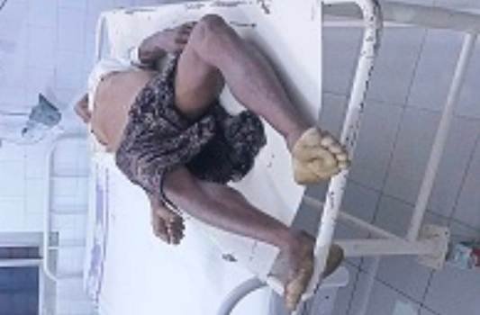 ସଡ଼କ ଦୁର୍ଘଟଣାରେ ବୃଦ୍ଧାଙ୍କ ମୁତ୍ୟୁ