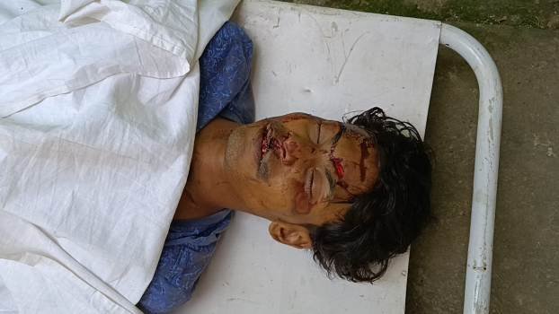 ଦଲକିରେ ଅଜଣା ଗାଡ଼ି ଧକ୍କାରେ ଯୁବକ ମୃତ