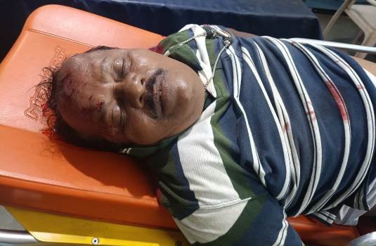 ଅଜଣା ଟ୍ରାକ୍ଟର ଧକ୍କାରେ ଗୁରୁତର