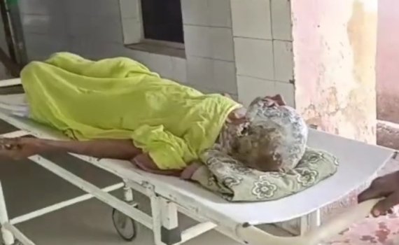 ନିଆଁରେ ପୋଡିହୋଇ ବୃଦ୍ଧା ଗୁରୁତର