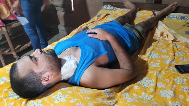 ଦୁଇଟିଯାକ କିଡିନ ଅଚଳ, ବାପା କରିବେ କିଡିନି ଦାନ