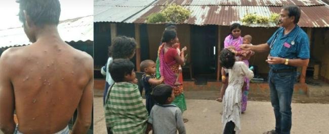 ଦୁର୍ଗମ ଅଞ୍ଚଳ ଗାଁରେ ହାଡଫୁଟି ଆତଙ୍କ