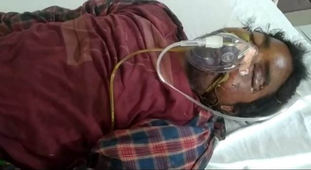 ଵହଳଦାର ବହୁ ଚର୍ଚ୍ଚିତ ଆନ୍ତଃ ରାଜ୍ୟ ଦୁର୍ଦାନ୍ତ ଅପରାଧୀ ଶ୍ୟାମ ଵିରୁଆର ଚିକିତ୍ସାଧୀନ ଅବସ୍ଥାରେ ମୃତ୍ୟୁ