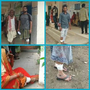ପାଗଳ କୁକୁର କାମୁଡାରେ ୧୫ ଆହତ