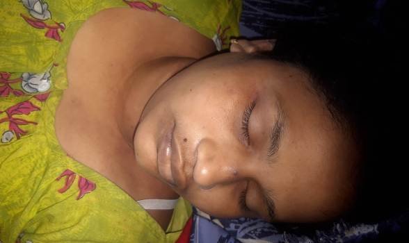 ସୁନହଟ ଠାରେ ମହିଳା ବେକରେ ଫାଶୀ ଲଗାଇ ଆତ୍ମହତ୍ୟା ଅଭିଯୋଗ