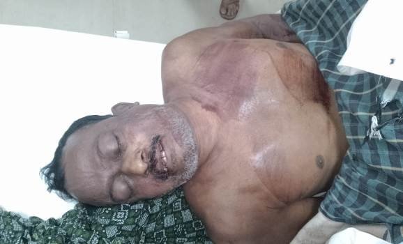 ଟ୍ରାକ୍ଟରରେ ବେଟେରୀ ସଂଯୋଗ ବେଳେ ଟ୍ରାକ୍ଟର ଚଢି ଯିବାରୁ ଜଣେ ମୃତ୍ୟୁ